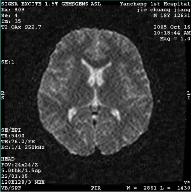 ARTIFACT WI/ภาพ Fiesta พิกเซลสีขาว